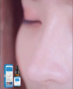 West Month Oil Essential Nose Lift Up Nourishing Nasal Bridge And Wings Massage For Firming Natural Lift And Moisturizing 10ml