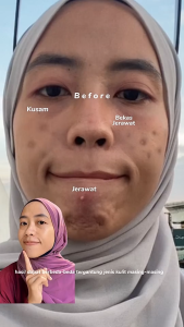 HANASUI Exfoliating Serum Gentle Advance Formula with AHA BHA PHA Brightening and Smooth Skin in 8 Days - 20ml