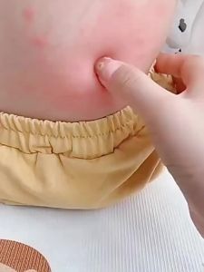 ORGINESE | Mosquito Repellent Essential Oil Patch