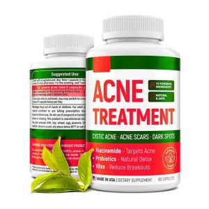 ACNE TREATMENT PIMPLES REMOVAL