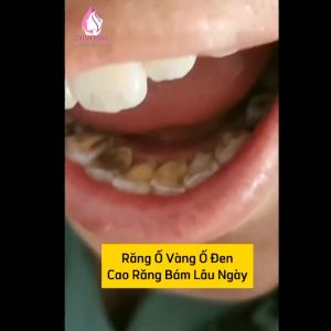 Bột Đánh Răng Giúp Làm Sạch Khử Mùi Khử Khuẩn Chăm Sóc Bảo Vệ Răng Luôn Trắng Sáng Và Chắc Khỏe (50g)