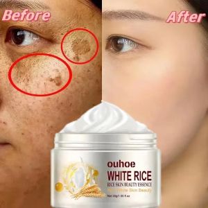 White Rice Whitening Cream Remove Dark Spots Fade Freckle Melanin Repair Product Anti Wrinkle Moisturizing Brighten Facial Care2026