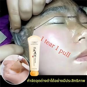 Peel off Instant Freckle Removal Mask การรักษาที่มีประสิทธิภาพ Chloasma สีรอยแผลเป็นจากสิวจุดด่างดําผลิตภัณฑ์ดูแลผิวหน้า