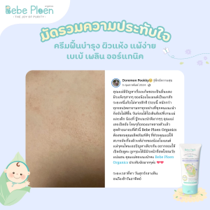 ครีมเเก้ผิวเเห้งผดผื่นออร์เเกนิค เบเบ้ เพลิน ออร์เเกนิค