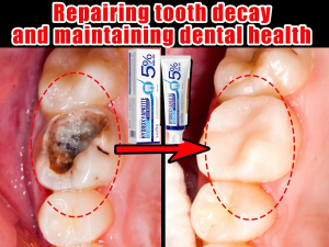 Hydroxyapatite toothpaste Anti-caries toothpaste teeth repair toothpaste Tooth Decay Repair deep cleaning Enhance tooth hardness and reduce tooth sensitivity teeth whitening tooth