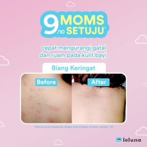 Loluna Cerapair Baby Rash Cream 30ml Tanpa Parfum Krim anti ruam Anti Iritasi Gatal  Loluna Cerapair