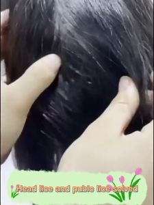 Head lice remover shampoo head lice and nits anti head lice removal shampoo for kids adults baby with shower cap and comb Quickly Kills head lice pubic lice larvae and lice eggs  Anti Dandruff shampoo Oil Control Anti-Dandruff Repair damage shampoo