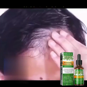 【Ready】EELHEO Rosemary Essential Oil / Stimulates Hair Growth / Strengthens Hair/ Advanced Essential Oil For Hair Growth 30ML