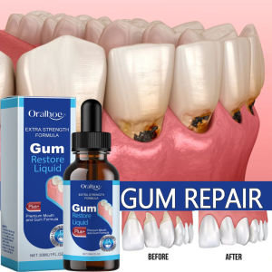 Rapid Damaged Gum Repair Care Serum Relieve Tooth Allergy Dental Caries Tooth Cleaning Toothpaste Relieve Tooth Damage Drops