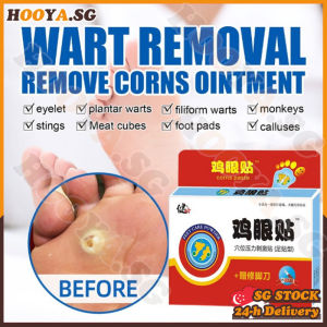 ✅𝙎𝙂 𝙨𝙩𝙤𝙘𝙠✅ Corn plaster removal / Corn patch / Chicken eye removal / Corn removal foot corn remover / 雞眼貼 / 雞眼去除 / 鸡眼贴 / 雞眼膏