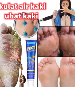 Kem Bôi Chăm Sóc Da Chân Foot Care Cream Hỗ Trợ Giảm Ngứa Bong Tróc Hôi Chân Nấm Kẽ Chân 20G Chính Hãng Dịu Nhẹ An Toàn