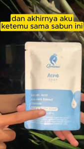 (Bayar di Tempat) Sabun Pemutih Badan dan Wajah Queensi Soap 9X Lebih Cepat Mengatasi Jerawat
