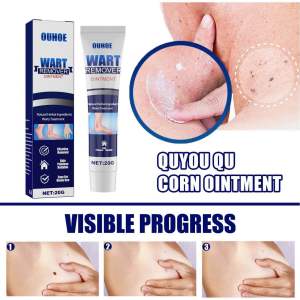 OUHOE WART REMOVER OINTMENT Krim penghilang semua jenis ketuat matikan akar ketuat