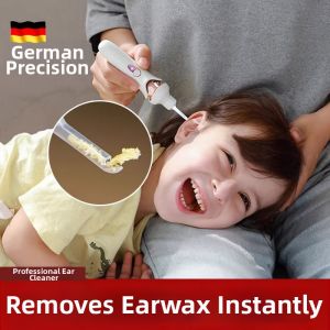 MENGYUXI | Child Safe Soft Glowing Ear Wax Remover
