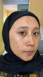 Ms Glow Paket Beauty White Cell DNA | Day Cream / BB Cream | Mencerahkan Kulit | Glowing Treatment