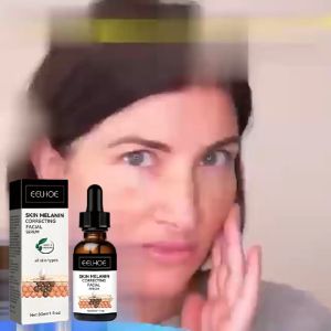 EELHOE 30ml Essensi Perbaikan Melanin & Pemutihan