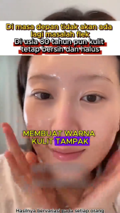velltrua gel Dark Spot krim jeragat paling berkesan jeragat degil berkesan dark spot cream Penghilang flek hitam cepat melasma cream pigmentation Whitening freckle removal cream