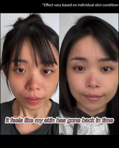 TRUU ExoRegenPro+™ Royal Jelly Youth Renewal Cream