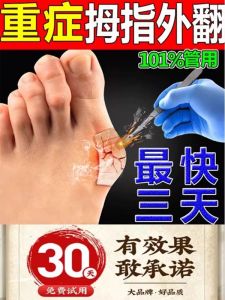Foot Big Bone Externally Deviated Correction Sticker One Patch Correction Toe Joint Deformation Correction Tool BONBONE