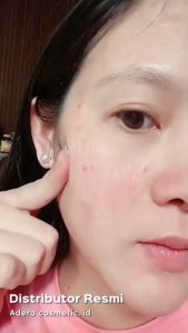 ADERA DARKSPOT SERUM Penghilang Flek Hitam Keriput dan Bekas Jerawat di Wajah Wanita dan Pria BPOM 100% Ori - Adera Darkspot Anti Aging Serum Mengatasi Flek Hitam Membandel - Bisa COD