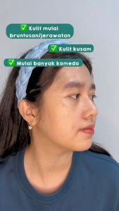 HIMALAYA Purifying Neem Face Scrub 100ml / 50ml - Scrub Wajah Untuk Jerawat Acne Skincare