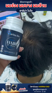 1แถมฟรีอีก1กระปุก Harina Bio ฮาริน่า ไบโอ 1แถม1 วิตามินบำรุงผม อาหารเสริม ลดผมร่วง ผมล้าน เพิ่มผมดกหนา ช่วยให้รากผมแข็งแรง