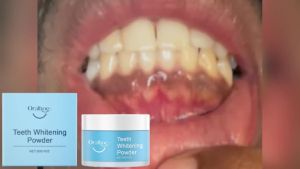 oralhoe | Teeth Whitening Powder Natural Tooth Stain Removing Powder Remove Coffee Tea Smoke Yellow Stains Fresh Breath Oral Cleaning Care
