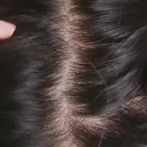 The Body Shop Ginger Anti-Dandruff Shampoo 400ml: Anti-Hair Loss Treatment, Hair Grower & Conditioner