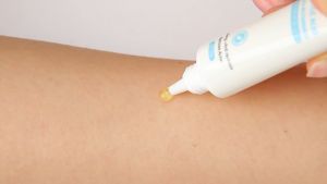 ครีมแต้มสิว กรดซาลิไซลิก รูขุมขนหดตัว ช่วยลดปัญหาสิว รอยสิวจางลง 20g.