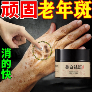 DONGYAN | Elderly Spots Removal Cream