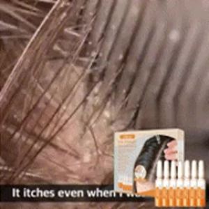 EELHOE | Hair Care Ampoules Effectively Promoting Hair Growth Strengthen Hair Roots Prevent Hair Loss Moisturizing Scalp Repair Essence
