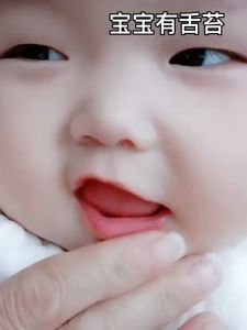 TAIYO Sikat Gigi & Lidah Bayi 2in1 Newborn Baby Pembersih Mulut Bahan Silikon Lembut