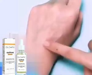 Essence Pemutih Bercak dengan Kunyit OUHOE 30ML