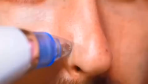 Delivering beauty New blackhead remover pore remover acne face wash cleansing facial instrument electric blackhead remover