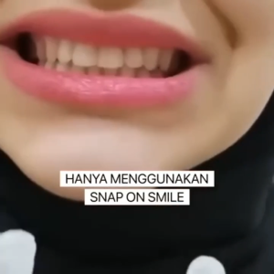 EELHOE Smart Eelhoe Adjustable White Gigitiruan Veneer Gratis Elastis Dan Disesuaikan Dengan Sempurna Untuk Berbagai Gigi