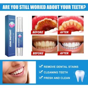 Gum Instant Soothing Gel gum therapy gel Teeth Whitening Treatment Tooth loosening Inflammation Treatment