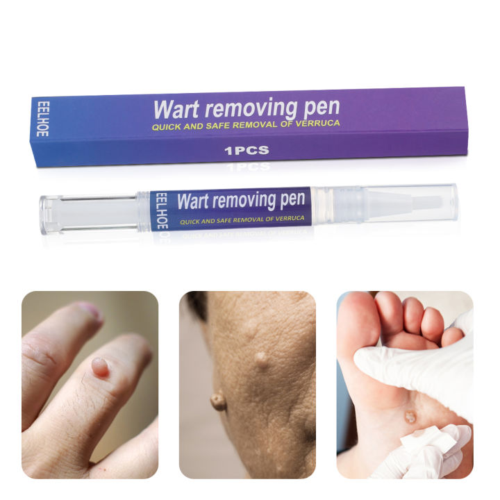 Hailicare warts removal pen eliminate wart pen wart liquid hand foot ...