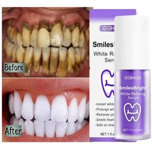 EELHOE | Whitening Toothpaste Teeth Cleansing Whiten Gel Whitener Bleach Removes Stains Fresh Breath Tooth Cleaning Korea Products