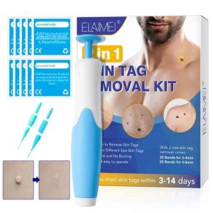 2 In1 แท็กผิวอัตโนมัติ Mole Wart Removal Kit ไม่เจ็บปวดเครื่องมือทําความสะอาด Face Skin Care Body Wart Dot การรักษาสําหรับ 2-8 มม.สุขภาพความงาม