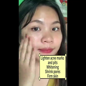 Salep Jerawat Acne Night Cream 50gr BPOM Krim Penghilang Bekas Jerawat Obat Jerawat paling ampuh Acne Day Cream Whitening Salep Bopeng Flek Noda Hitam Anti Acne Mengecilkan Poripori Mencerahkan kulit Memperbaiki Skin Barrier Acne Spot Treatment Expert