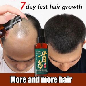 Hair Growth Serum Hair tonic Hair Repair Essence Anti Loss Hair Growth Oil Hair Loss Treatment Roots Booster Tonic Hair Care Essential Liquid
