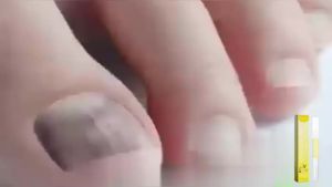 OceAura  Minyak Penjagaan Kuku Lemon   Kuku Pelembap Pembaikan Berkhasiat untuk Menghilangkan Onychomycosis Kuku Berkilat Cecair Perawatan Kuku