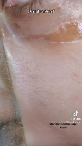 Masker komedo Gelatin kemasan 50 gram dan 100 gram