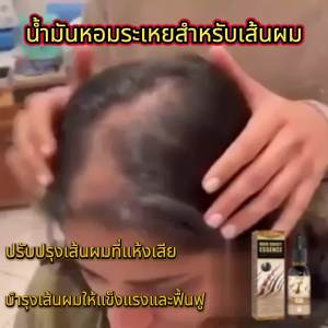 OUHOE น้ำมันหอมระเหยผมหนาแน่น ปรับปรุงผมแห้งชี้ฟูป้องกันผมร่วงบำรุงความแข็งแรงซ่อมแซมรากผมน้ำมันหอมระเหยดูแลเส้นผม