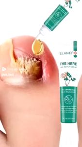 Obat Kuku Jamur & Perawatan Kuku: Solusi Terbaik untuk Kuku Rusak