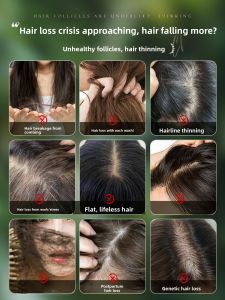 Sidecypress Leaf Shampoo Soap Handmade Hair Cleaning Oil Control Dandruff Removal Prevent Breakage Ussan Grass Traditional Chinese Medicine