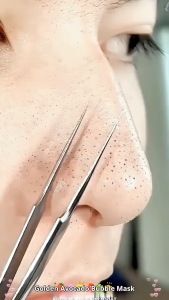 Vita Anthocyanin Green Bubble Mask Is A Deep Pore-Cleansing Oil-Control Hydrating Moisturizing And Brightening Mask. Suitable For Oily Dry And Sensitive Skin This Gentle Mask Can Shrink Pores Improve Acne And Clear Holes