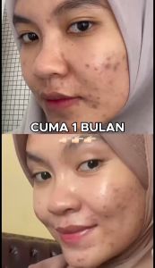 Ella Skincare Dreamy Glow Hyalumoist Gentle Moisturizer With Centella Asiatica Ceramide NP - Wajah Glowing Lembab Berkilau
