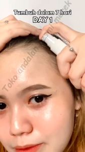 (SG local sellers) Hair Growth Serum Herbal Hair Growth Spray 100ML Hair Growth For Men And Women Anti Hair Loss Preventiom Prevents Balding Hair Growth Supplement Minoxidil 5%