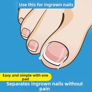 CMGF | Nail Correction Spacer Filler